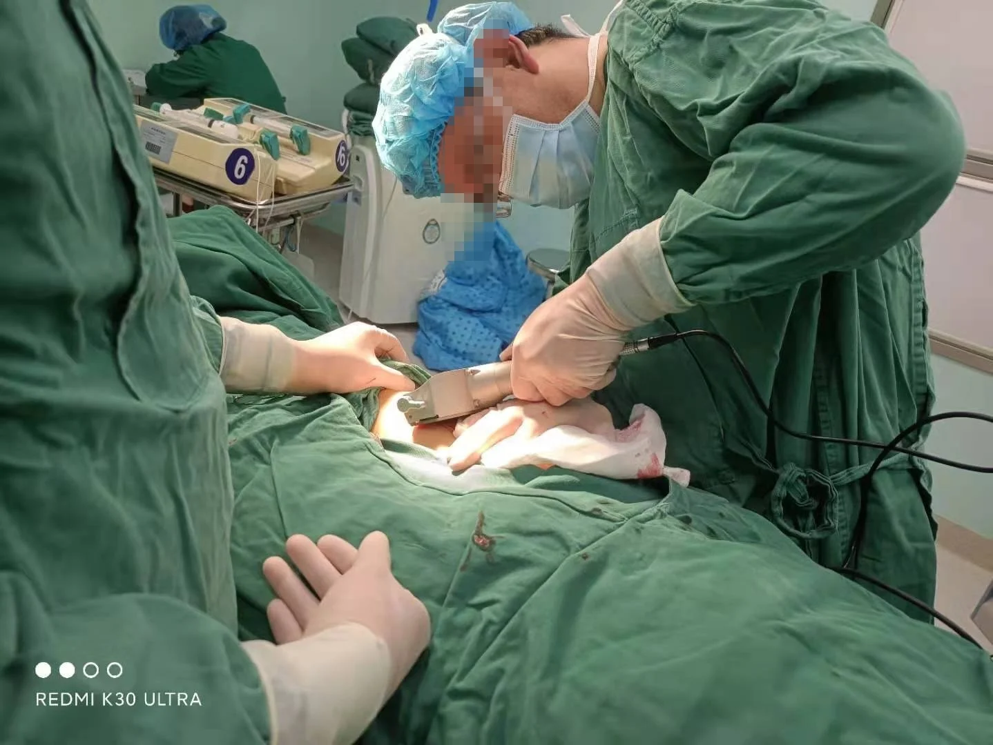 Medical Stainless Steel Electric Dermatome Burns Surgical Dermatome For Skin Graft