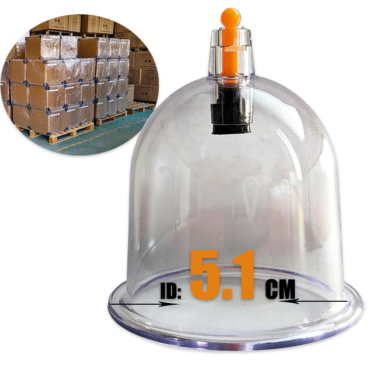 Y2 china vacuum cupping.jpg