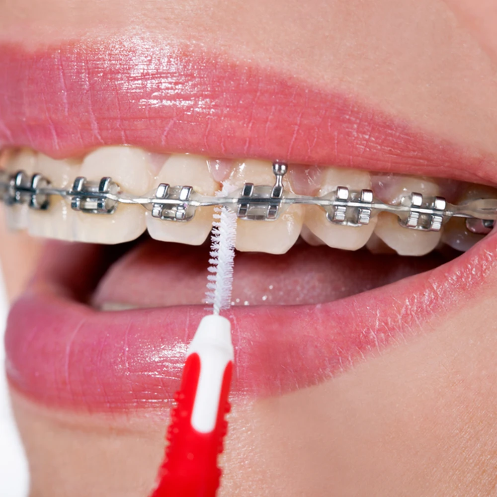 * Стоматологические расходные материалы Ortho products стоматологические чистящие наборы Ортодонтические ортодонтический набор зубных щеток межзубная щетка