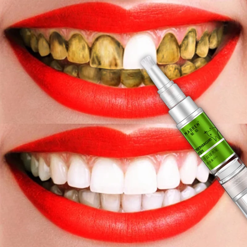 MABREM 5ml teeth brightening pen yellow stain tooth tartar serious plaque black spots removing cleaning whitening pen for smoke