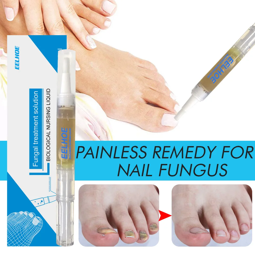 High Quality Nail Treatment Serum Foot Repair Liquid Care Effective Nail Repair Essence