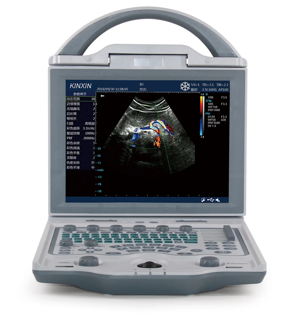 Hacemey animal veterinary ultrasound machine portable lcd screen vet color doppler ultrasound scanner for veterinarian