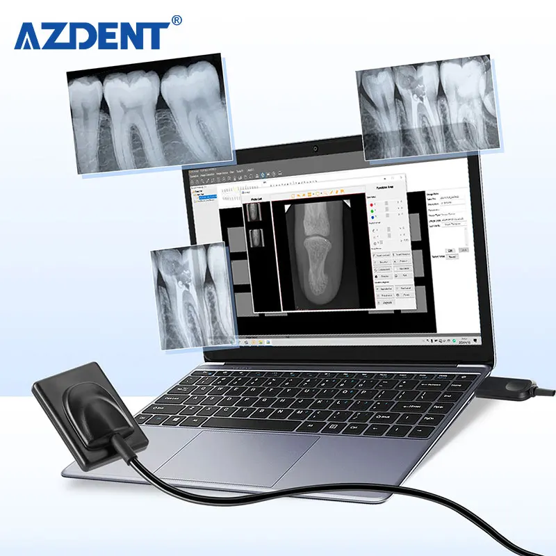 Хорошее качество Azdent стоматологический рентгеновский датчик цифровой хороший x Ray