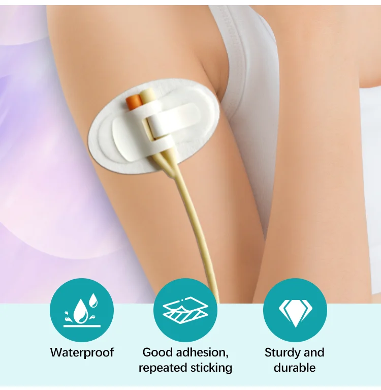 Catheter Stabilization Device PD Dialysis Patch Peg Tube J Tube G-Tube Holders Peritoneal Dialysis Accessories