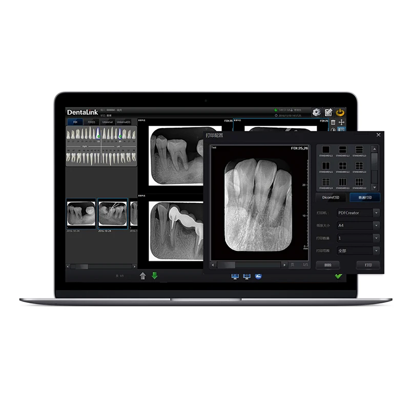 Digital Dental Imaging phosphor plate Scanner
