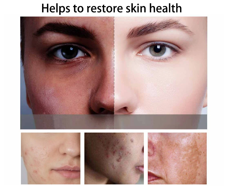 oem  spot removing lightening herbal 7 days beauty glowing skin whitening tea