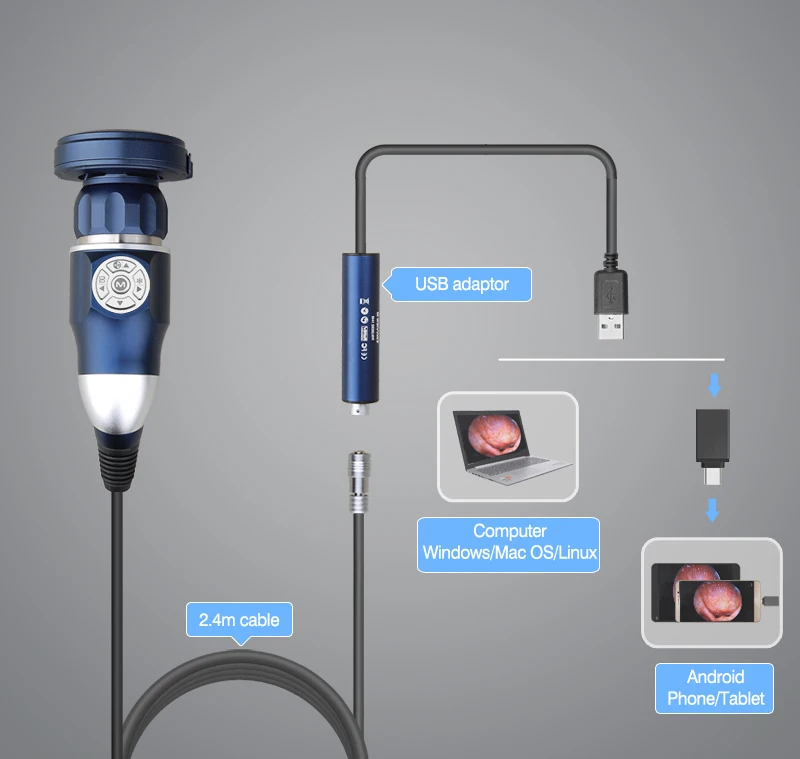 1080P USB full HD Endoscope Camera, HDMI Medical ENT Endoscope camera Portable Endoscope Camera