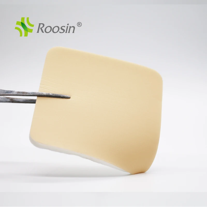 free sample Conforming stop bleeding foam medical dressing