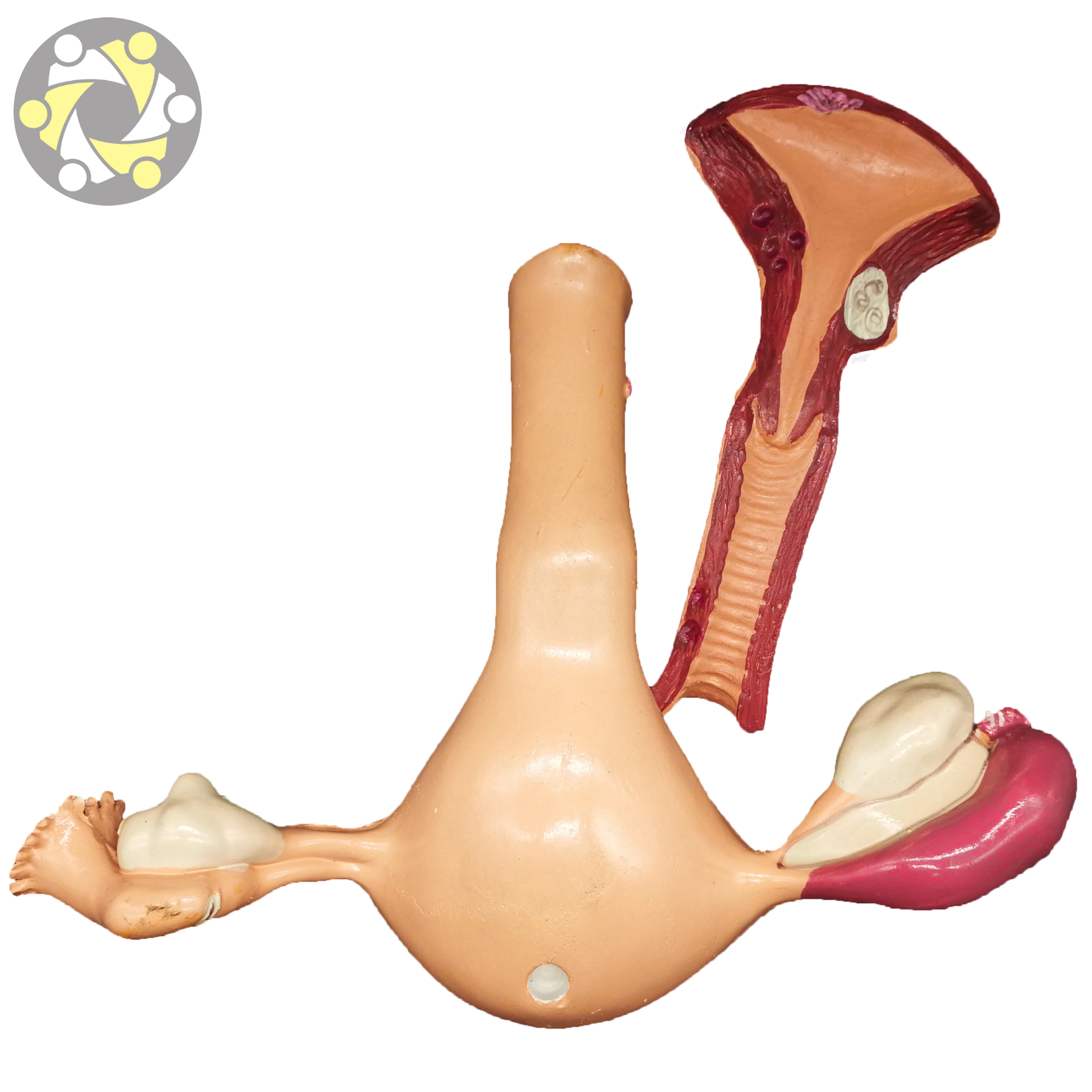 Female Uterine Fibroids Pathological Anatomical Model PVC Material for Medical Science and School Usage