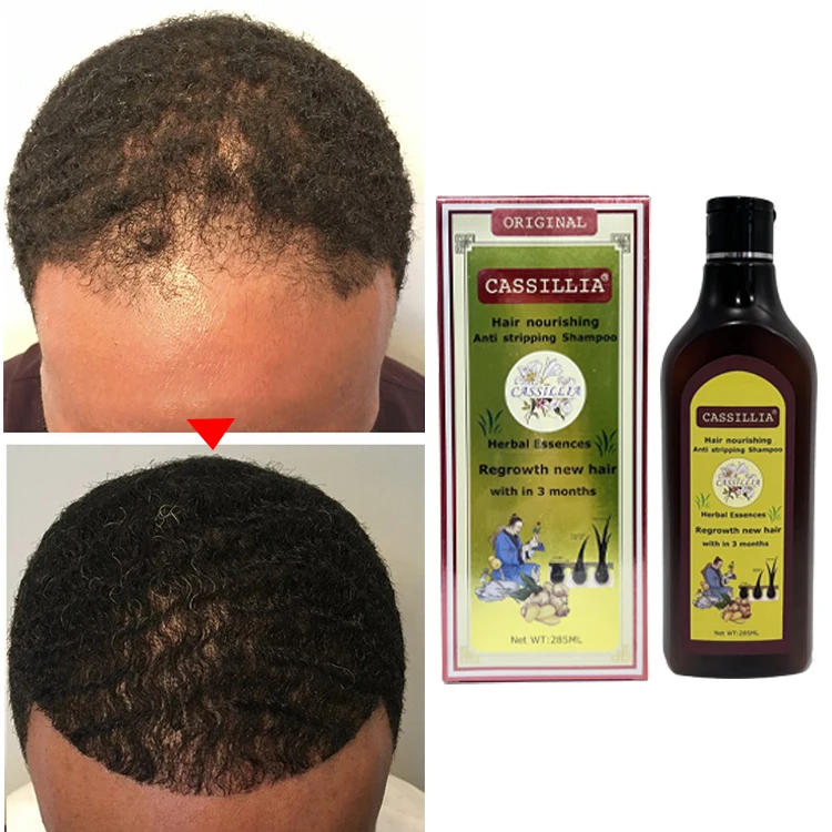 Herbal Hair Loss shampoo Treatment Growth Top Seller Organic Natural Private Label from China for Men Unisex OEM Suit Solid