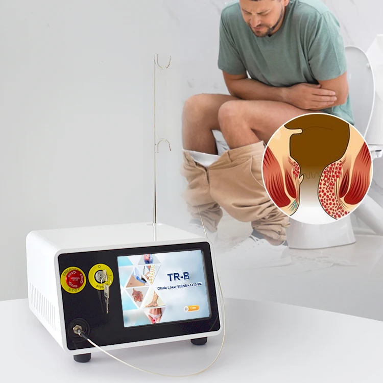 Dual wave 980nm 1470nm diode laser treatment hemorrhoid and hemorrhoid cutting