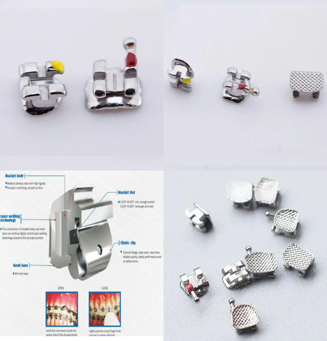 Dental orthodontics fixed teeth with high quality metal brackets/Dental orthodontic materials high-grade  metal brackets