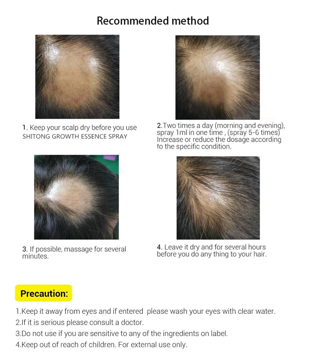 Natural wild anti hair loss private label fast hair growth oil spray for woman man