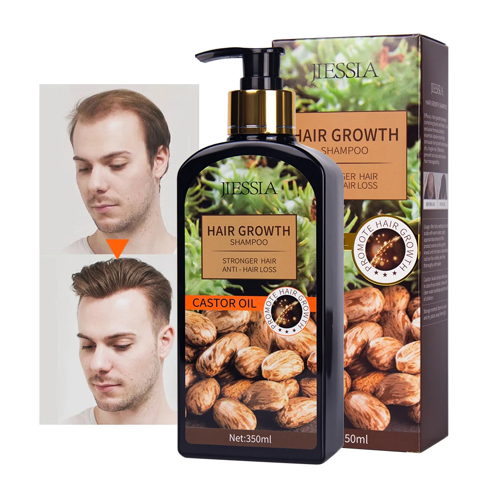Bald Castor Oil Hair Growth Anti-hair Loss Shampoo