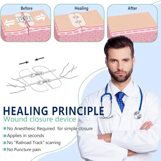 Extra Large Steri Strips Wound Closure Device, Waterproof Butterfly Wound Closure Strips