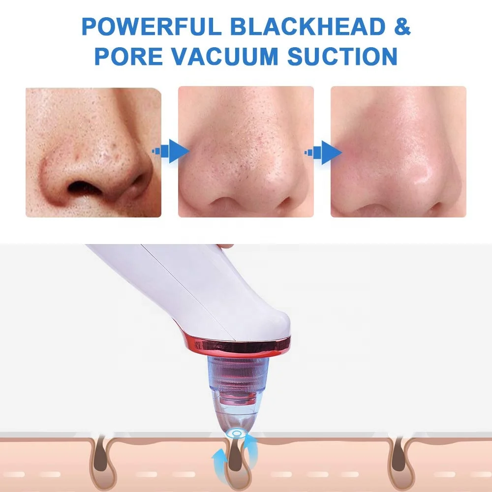 Dropshipping  Facial Pore Cleaner Suction Skin Care GiftBeauty Tool Deep Cleansing Electric Nose Face Vacuum Blackhead Remover
