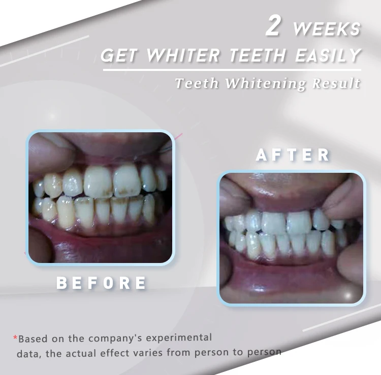 Hot Sale Professional Private Logo Travel Use Activated Bamboo Charcoal Teeth Whitening Strips