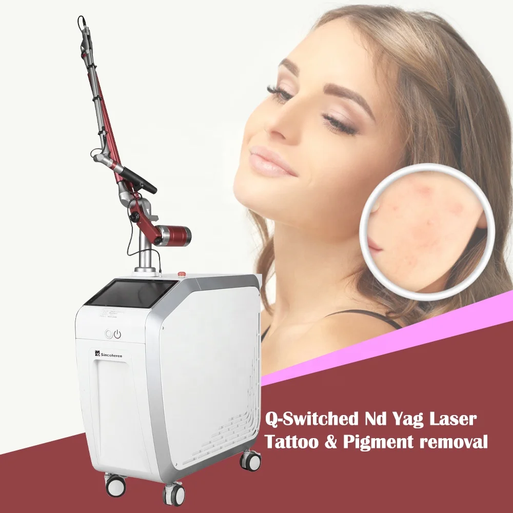 Sincoheren top popular professional tattoo removal pigmentation removal machine q switched nd yag laser device with CE approved