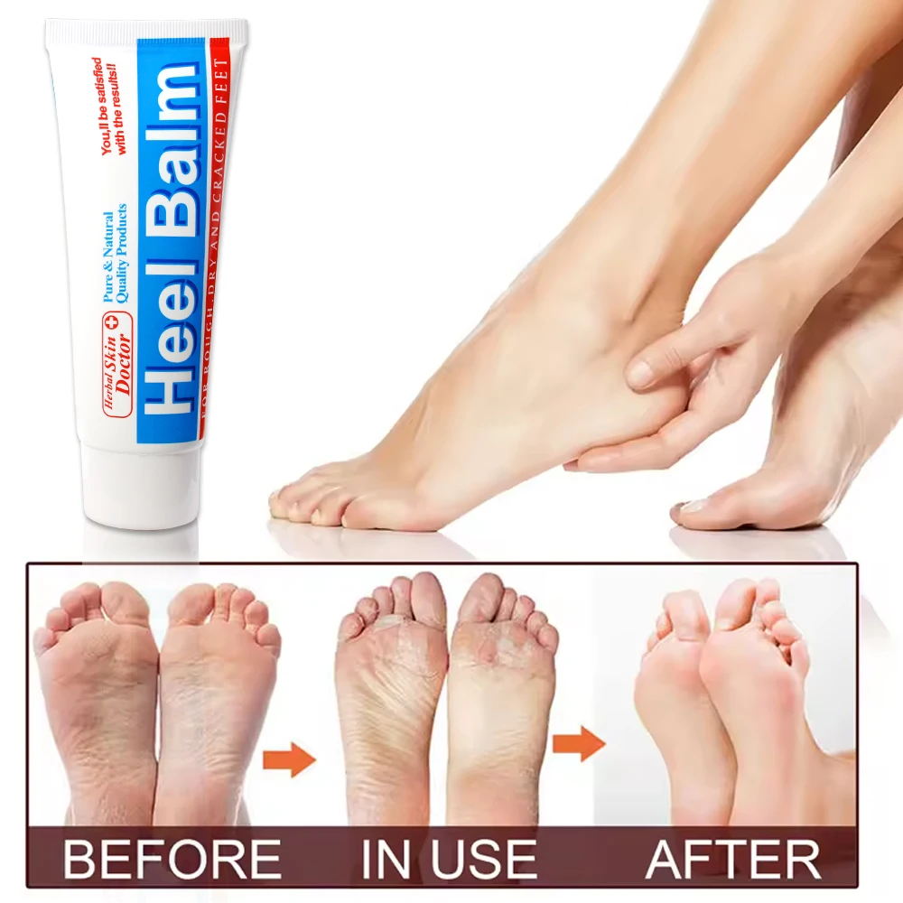 Dry Cracked Heel Callus Remover Heel Balm Skin Care Products Body Care Rejuvenating Set Moisturizing Foot Cream Balm