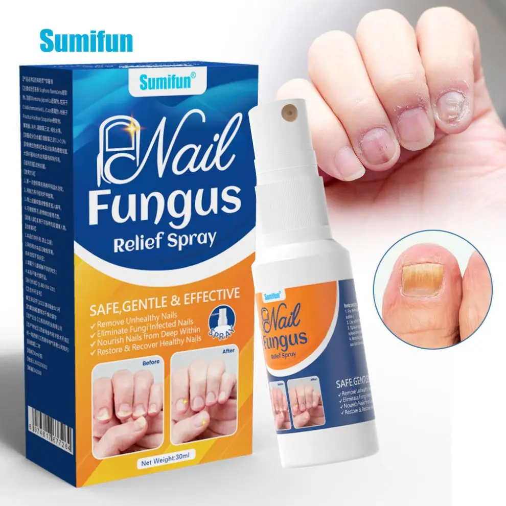 Wholesale Nail Fungal Treatment Finger Care Essence Anti Infection Finger Nail Fungus Removal Liquid