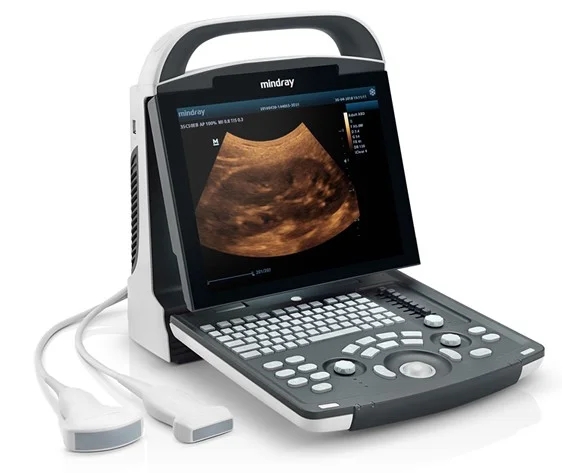 Original Factory Supply Mindray DP-10 Portable Medical Ultrasound Scanner Available price ultrasound scanner