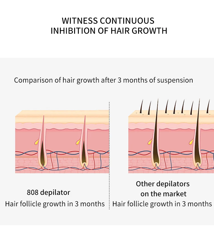 Professional Painless Depilation 808nm Diode Laser Hair Removal Ice Titanium Platinum Laser Machine 808nm Salon Beauty Equipment