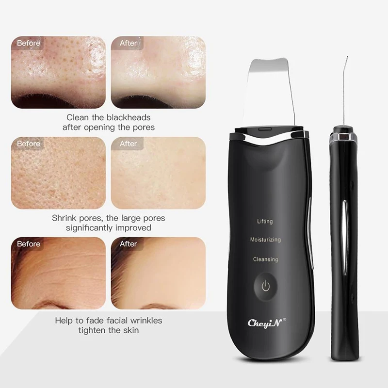 Electric Cleaner Portable Ion Ultrasonic Skin Scrubber Facial Exfoliating Scraper Skin Scrubber