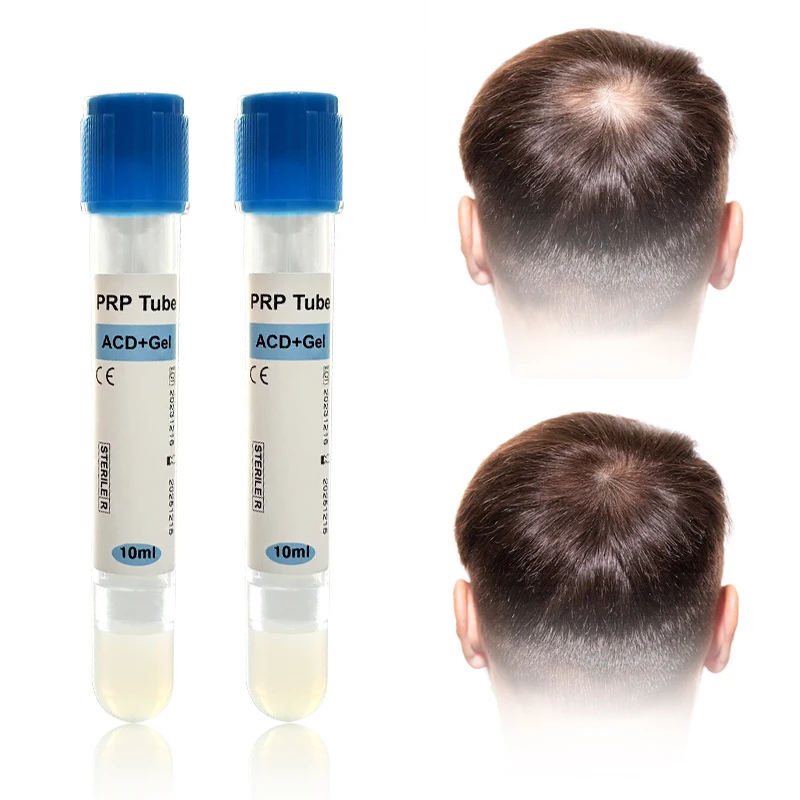 2024 New arrival 10ml platelet rich plasma prp acd tube for hair growth
