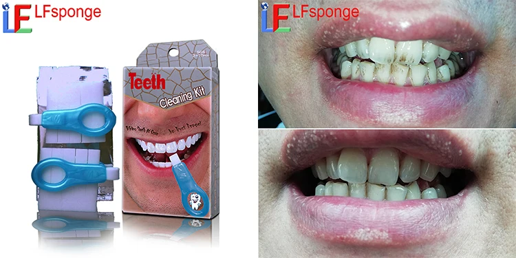 Whitener Teeth Eraser.jpg
