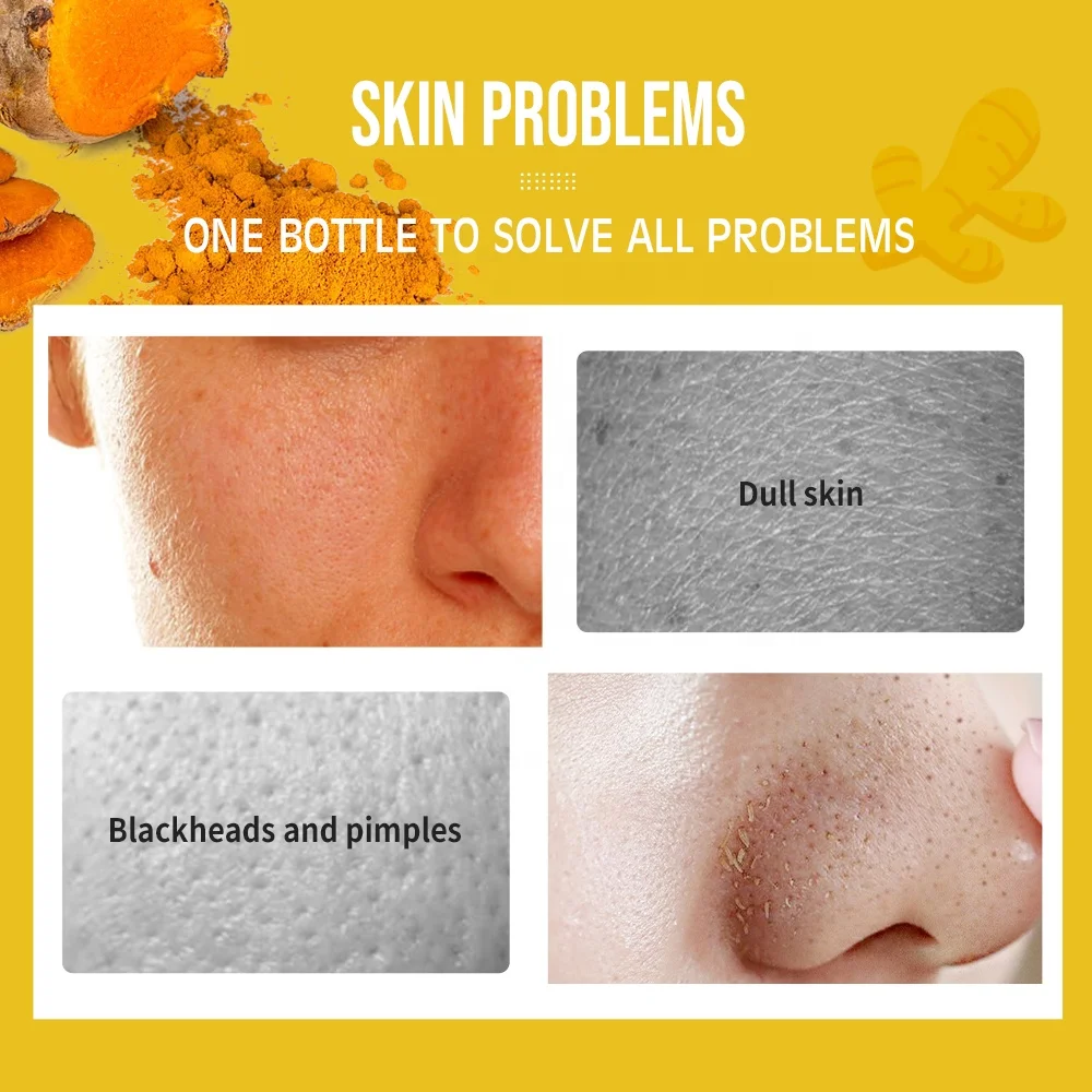New Arrivals Organic Ginger Turmeric Brightening Dark Spots Remove Skin Care Anti Acne Turmeric Vitamin C Face Serum