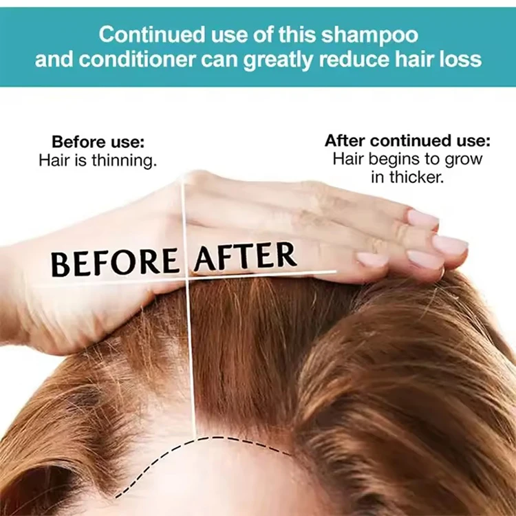 CHAOBA Natural Anti-Hair Loss Treatment Peppermint Hair Growth Shampoo and Conditioner Therapy with Rosemary Oils Biotin
