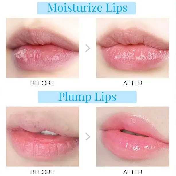 Oem Melasma пилинг с салициловой кислотой для коррекции темных пятен кожи Аква раствор химический лица профессионал