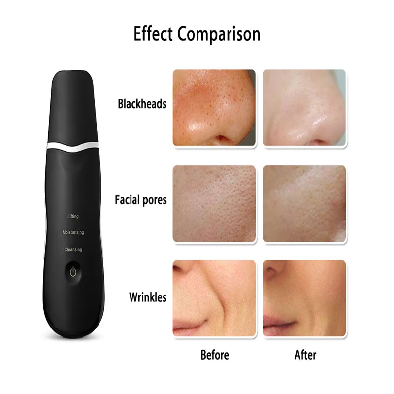 New Trending Products Ultrasonic Skin Scrubber Scraper and Gentle Peel Device 2022