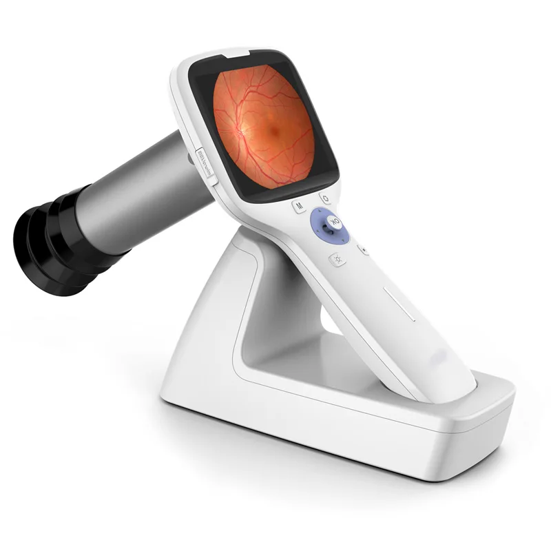 Portable Non-mydriatic Hospital Machine Handheld Eye Fundus Camera