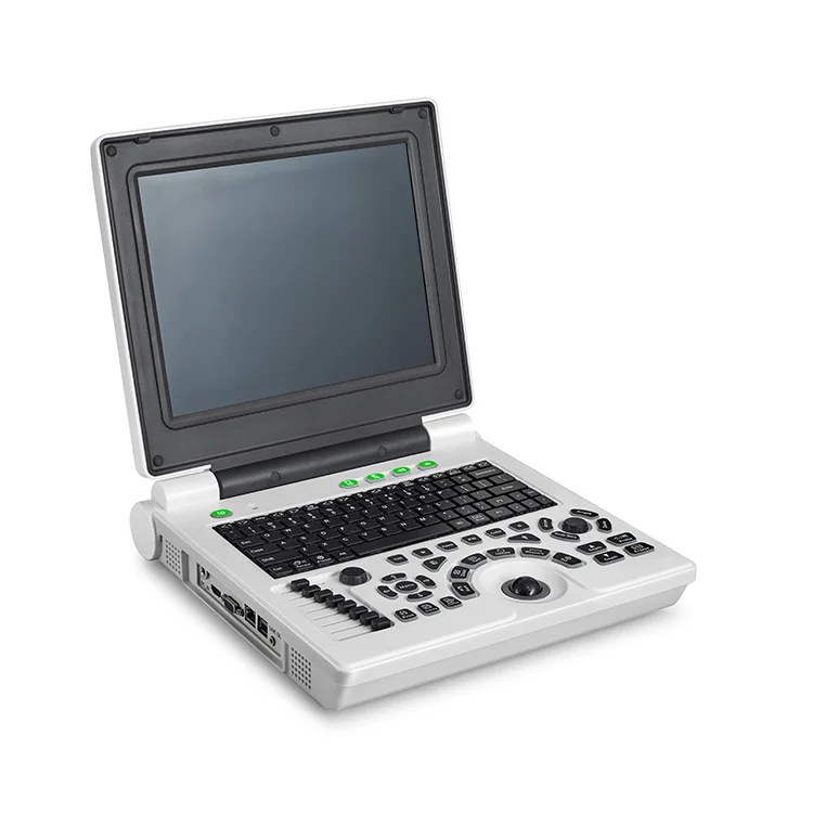 Black and white Laptop with Convex Array Probe China Portable Ultrasound Machine