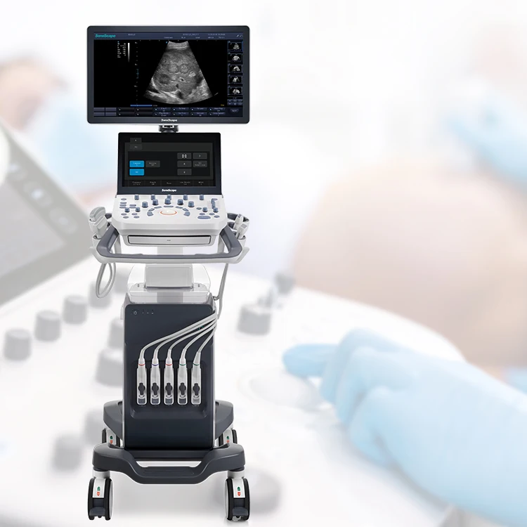 Ultrasound Machine Sonoscape P9 S22 Trolley Color Doppler Ultrasound System