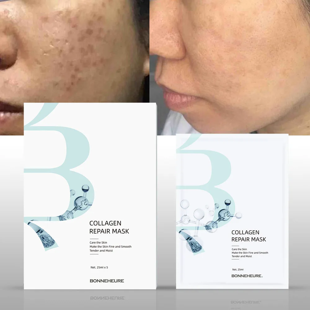 Sensitive Blemish Hydrating Moisturizing Calming Soothing Humanized Type III Collagen Face Mask For All Skin Types