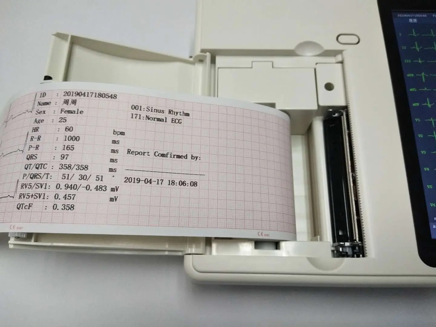  health care ecg machine ECG 30000 Cases Electrocardiografo Electrocardiograph Device 6