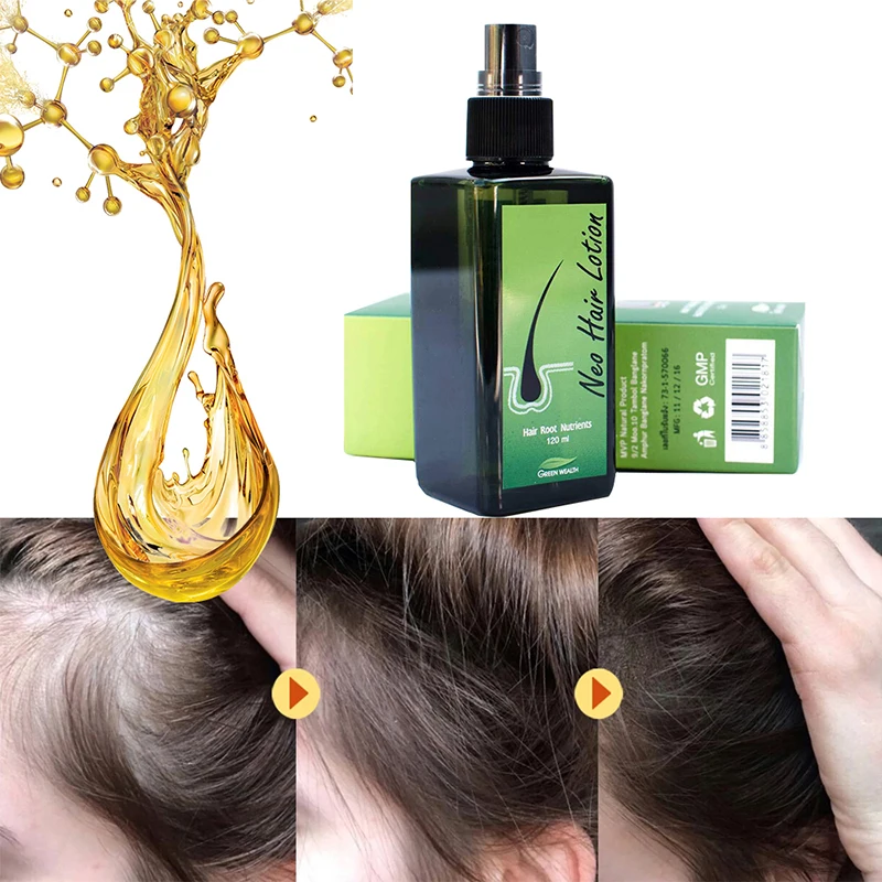Paradise Original Neo Hair Lotion Made in Thailand Hair Growth Oil Anti-hair Loss Lotion 120ml Scalp Treatment For Woman Man