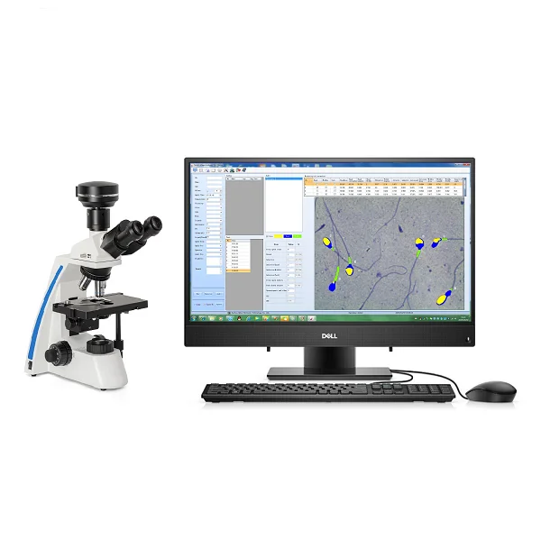 Top quality Sperm Analyzer price software for sperm concentration,motility and morphology