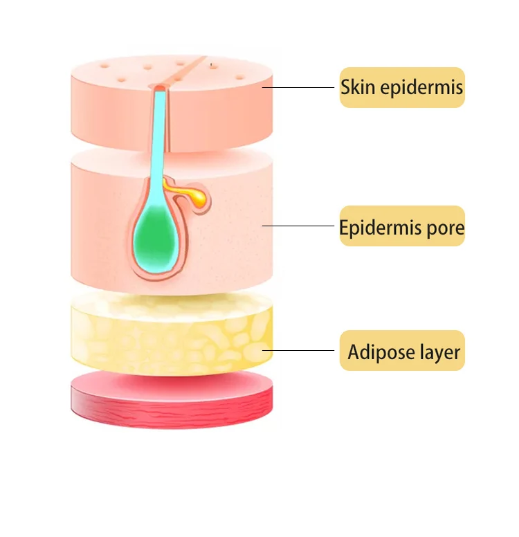 2021 Laser Other Beauty Machine Facial Hair Removal 755 808 1064 nm Diode Laser 810nm  Hair Removal Device