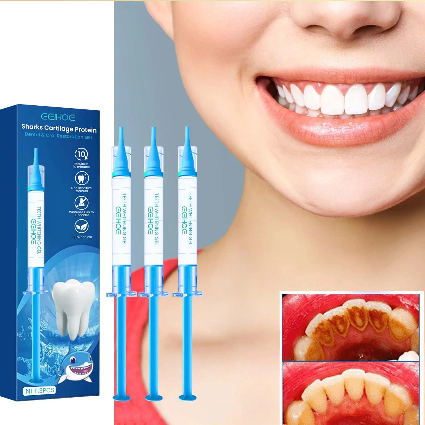 Professional Teeth Whitening Gel Dental Whitening Gel Tooth Whitening Gel