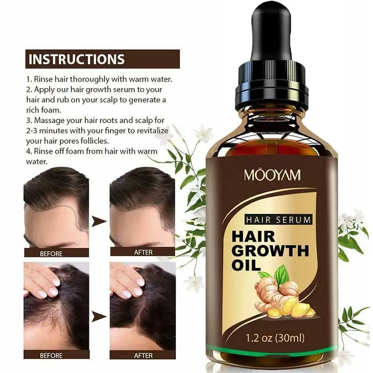 30ml Hair Loss Treatment Growth Oil Natural Hair Growth Essence Organic 7 Days Ginger Germinal Oil for Man Woman