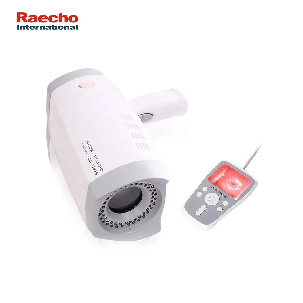 Good Quality Handheld Video Colposcope Digital Gynecology Hospital Convenient