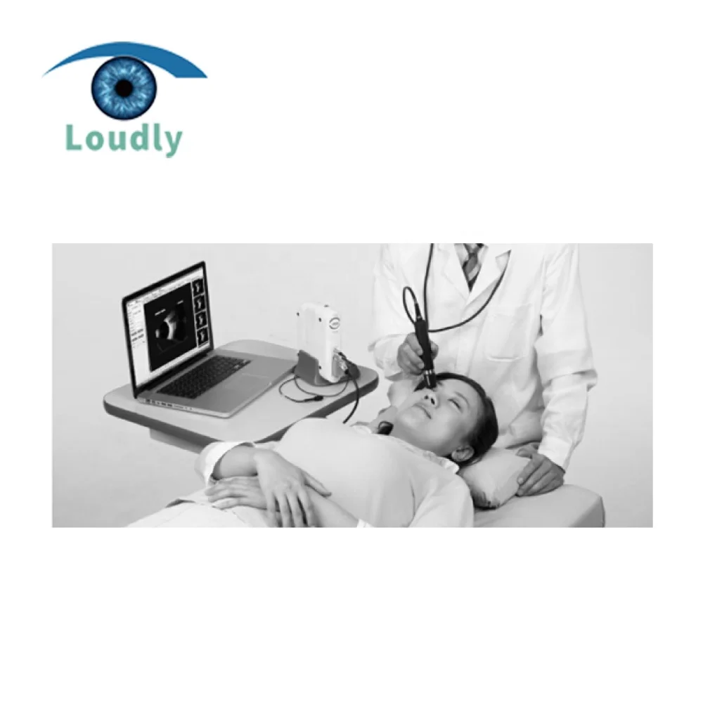 China Best Quality Optical Equipments China Ophthalmic Ultrasound AB Scan SW-2100