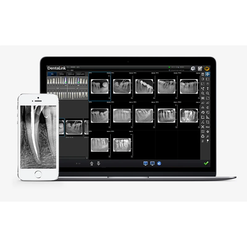 Digital Dental Imaging phosphor plate Scanner