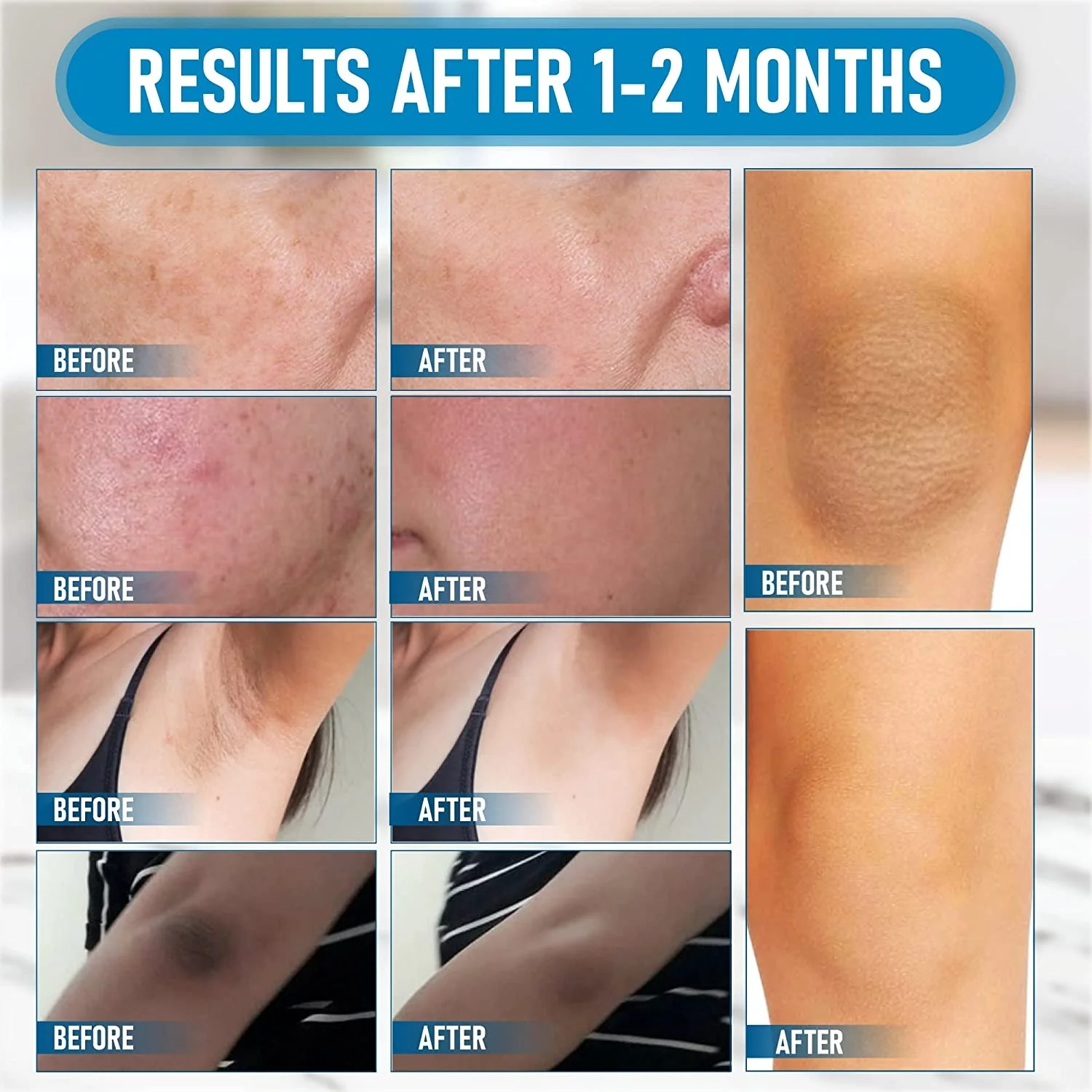 Niacinamide Whitening Cream Dark Spot Corrector Papaya Lightening Facial Cream