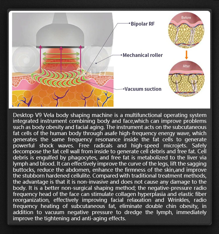 vela v9 machine (8).jpg