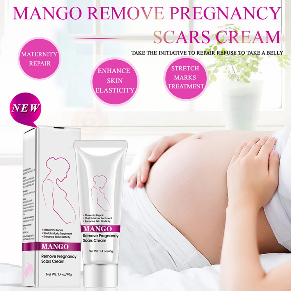 
2021 Hot Sale Remove Pregnancy Scar Mango Stretch Mark Removal Cream 