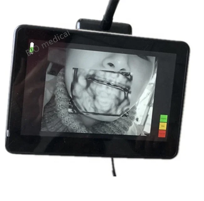 Medical 850nm Infrared Light Vein Finder Vein Scanner For Infants Children Obese